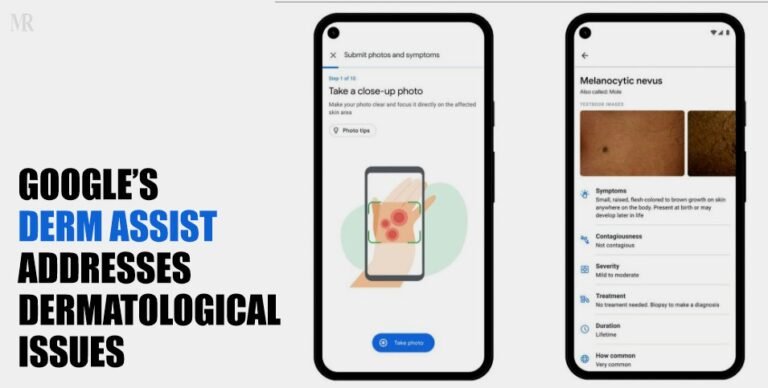 Google’s Derm Assist