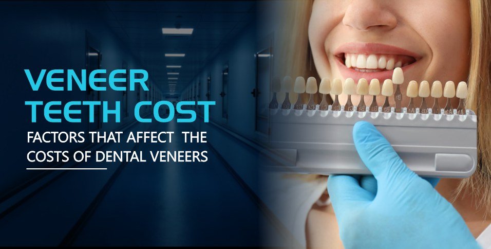 Veneer Teeth Cost