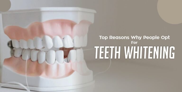 Top Reasons Why People Opt For Teeth Whitening