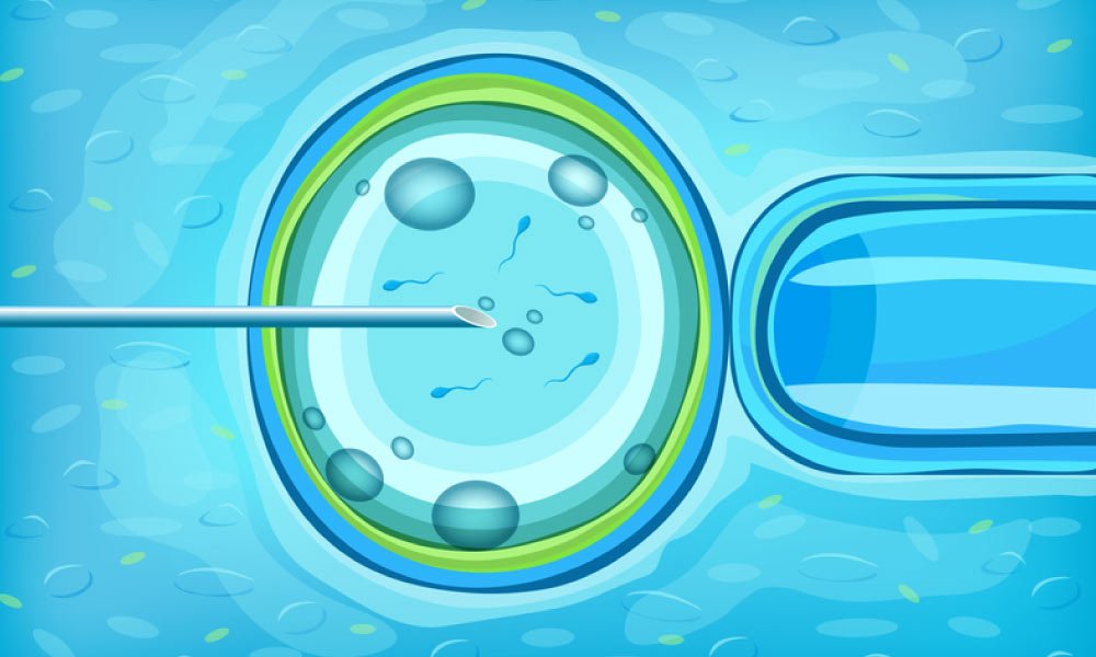 frozen-embryo-transfer