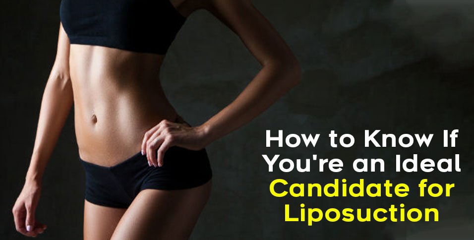 Candidate for Liposuction