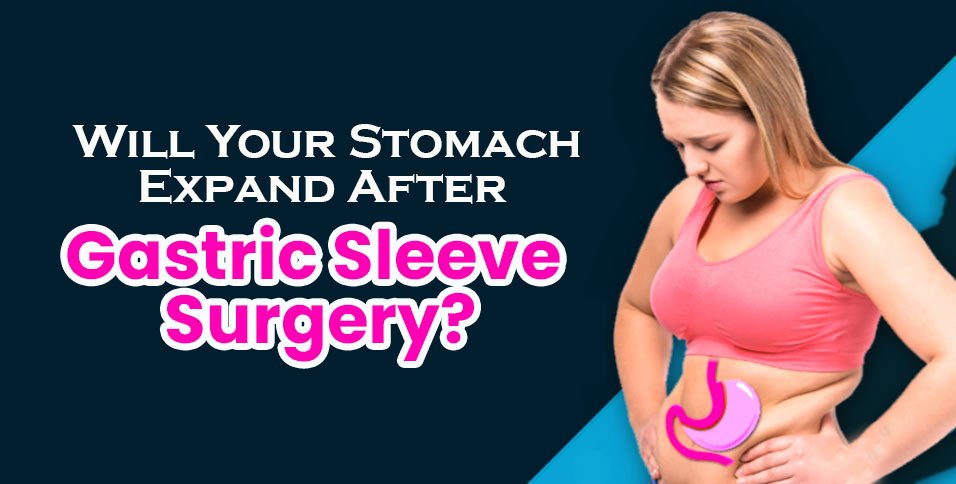 Gastric Sleeve Surgery