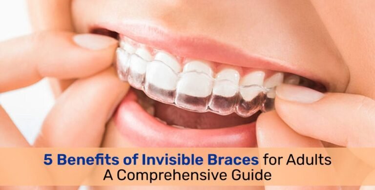 Invisible Braces for Adults