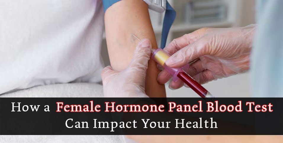Female Hormone Panel Blood Test