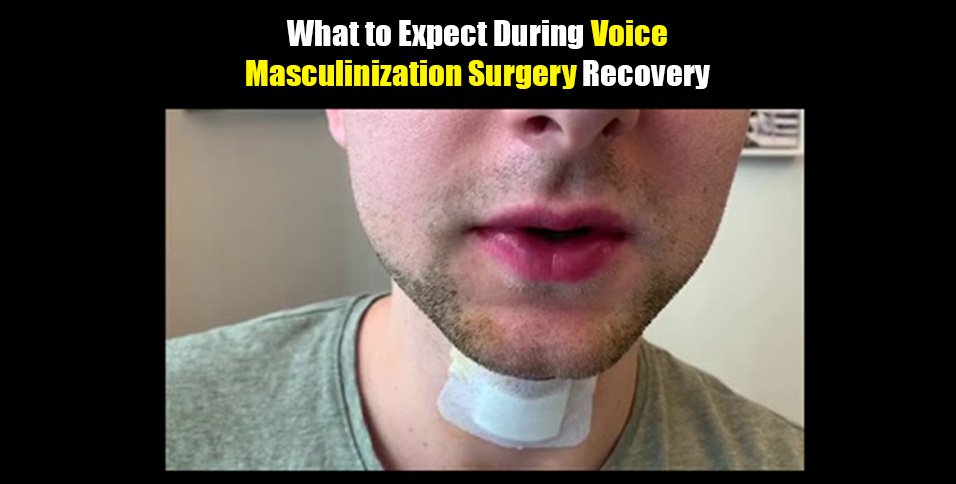 Voice Masculinization Surgery