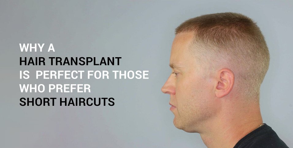 Hair Transplant