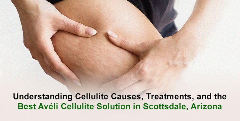 Best Avéli Cellulite Solution